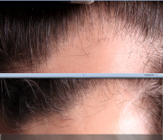 Elixir&Unisex Szampon na porost, wypadanie i siwienie włosów